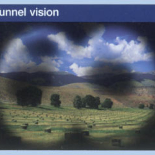 Glaucom vizual tunel